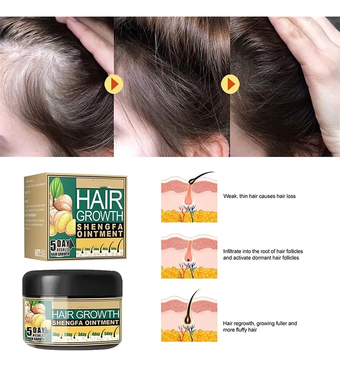 ALOPECIA Hair Growth - Crema para el Cabello (Oferta 2X1)