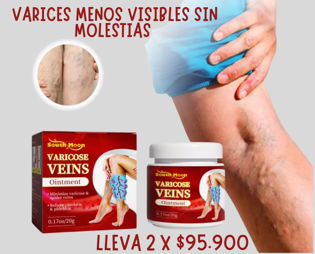 Crema Para Varices