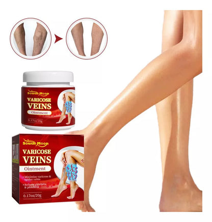 Crema Para Varices
