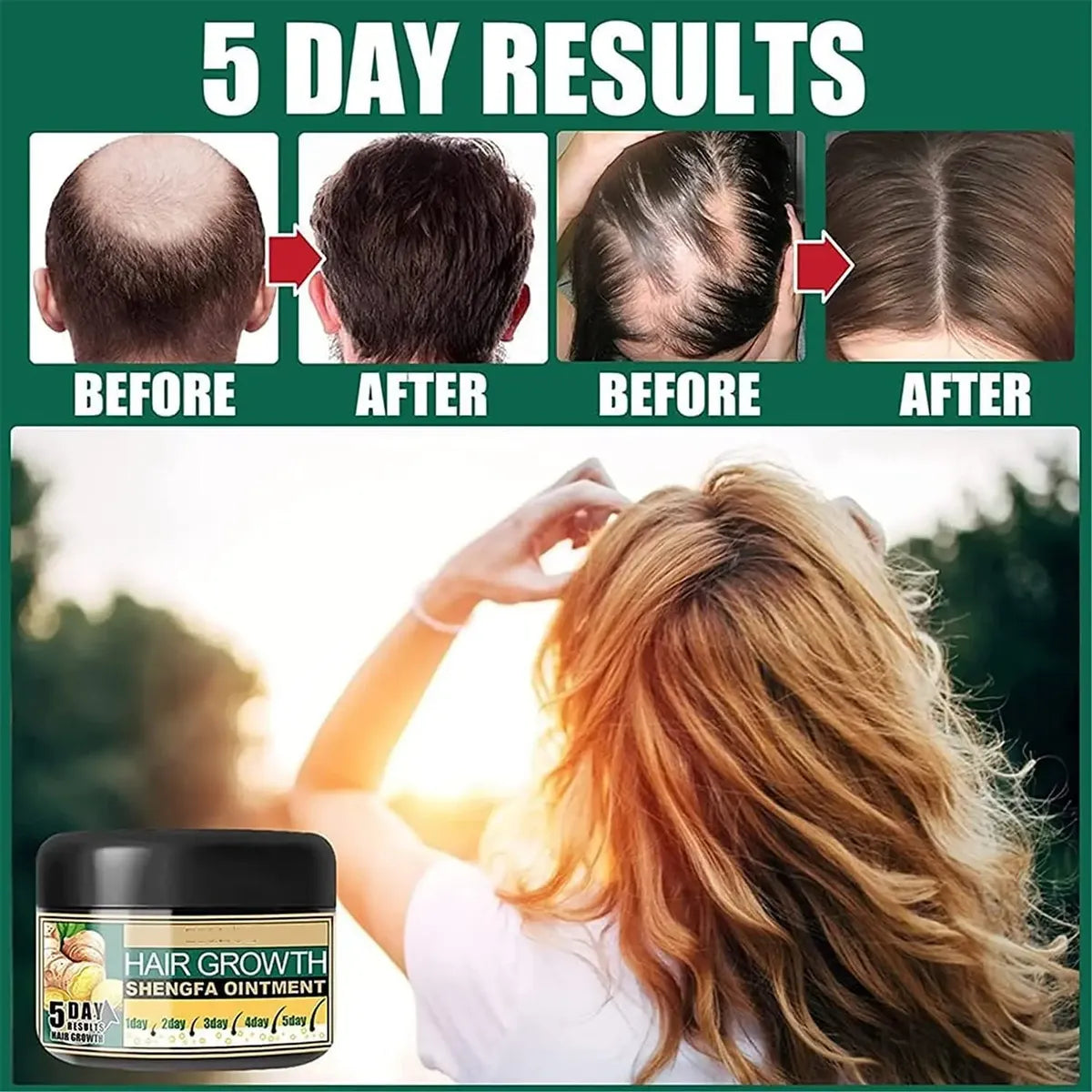 ALOPECIA Hair Growth - Crema para el Cabello (Oferta 2X1)