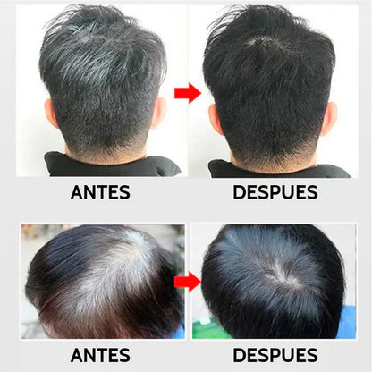 Shampoo Pinta Canas