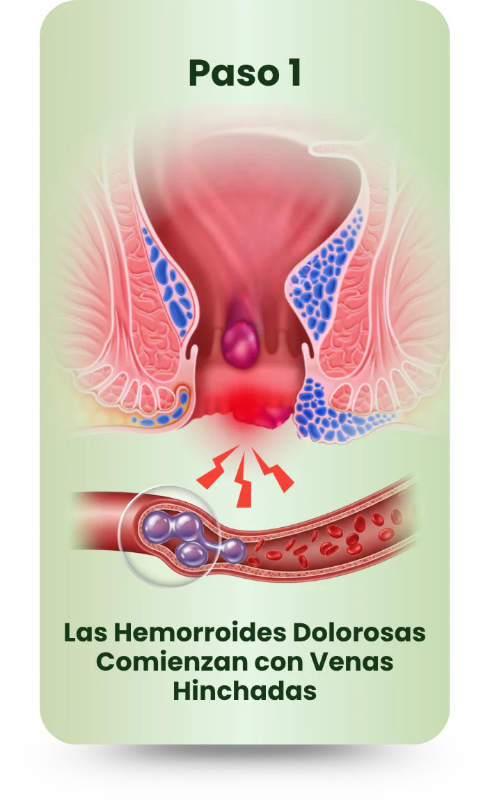 Imagen de diapositiva
