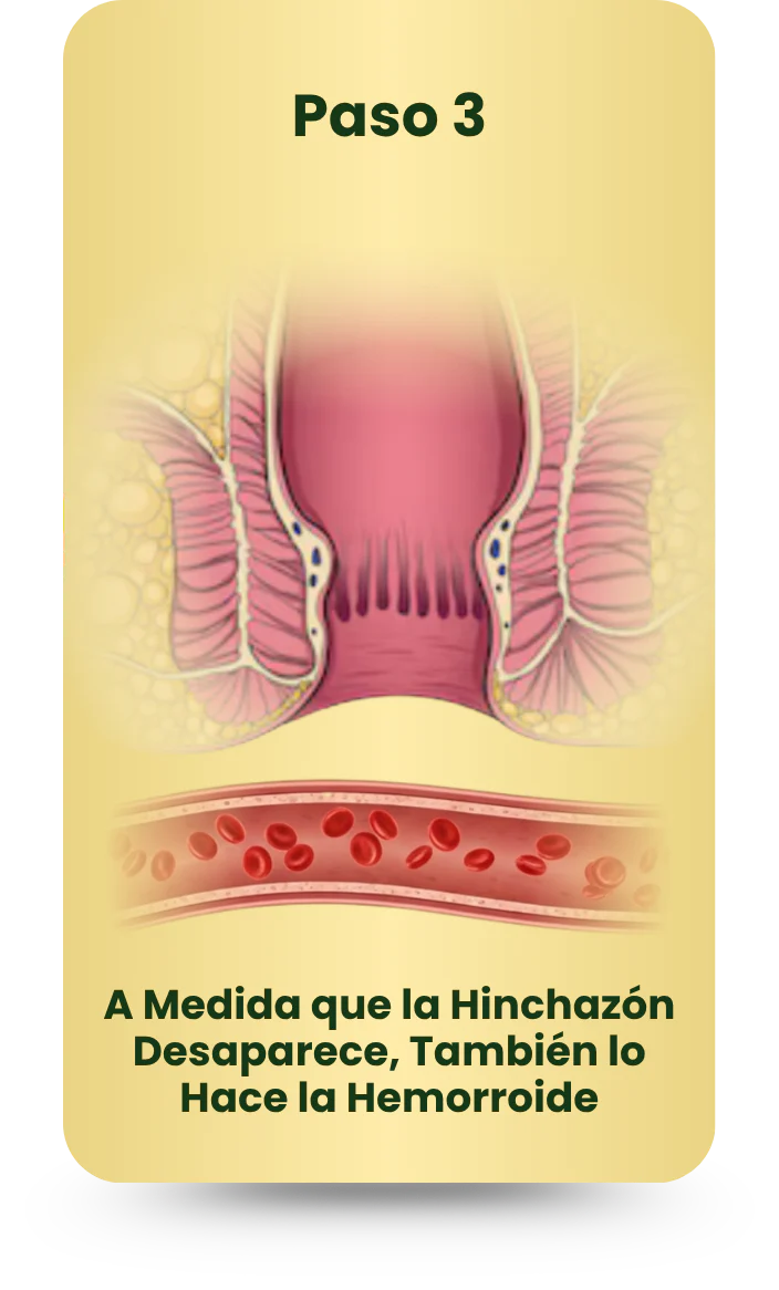 Imagen de diapositiva